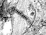ウイルス感染細胞の電子顕微鏡写真