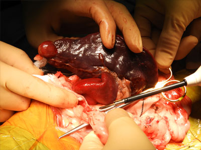 超音波凝固切開装置を用いた血管肉腫の脾臓摘出手術